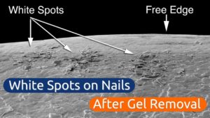 Manchas brancas nas unhas Danos ou desidratação